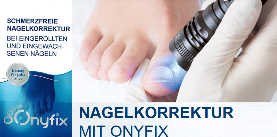 Onyfix bei eingewachsenen Fussnägeln